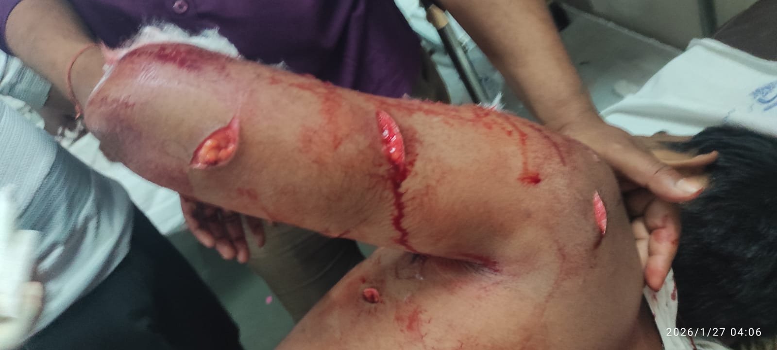 खामगावात! दरोडेखोरांच्या हल्ल्यात बाप-लेक गंभीर