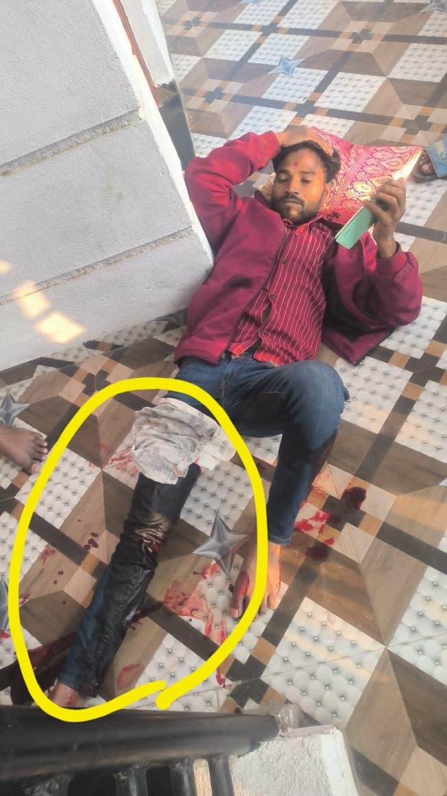 पत्नीने पतीच्या मांडीत खुपसला चाकू